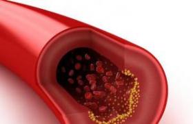Как правильно подготовиться и сдать кровь на холестерин?